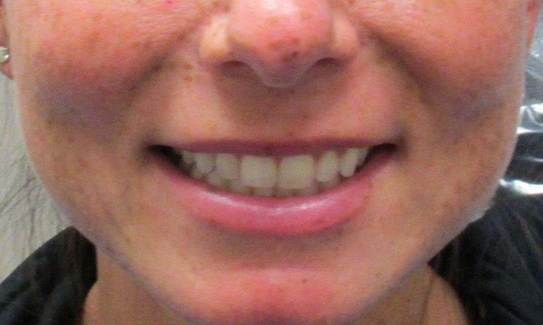 Temple TX Dentist Cosmetic Dentistry Temple Dental Trails