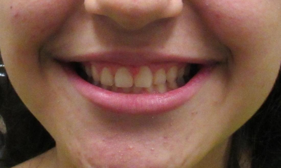 Orthodontist Temple TX Smile Gallery Dentist in Temple TX